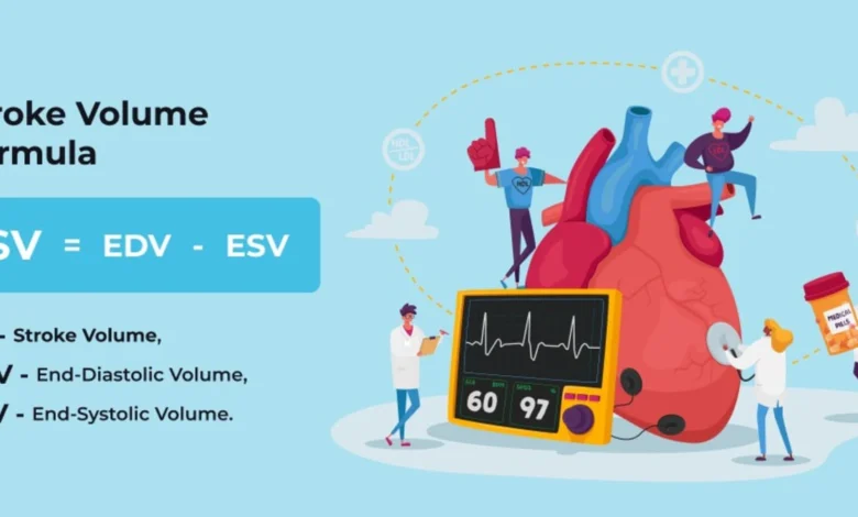 Stroke Volume Equation